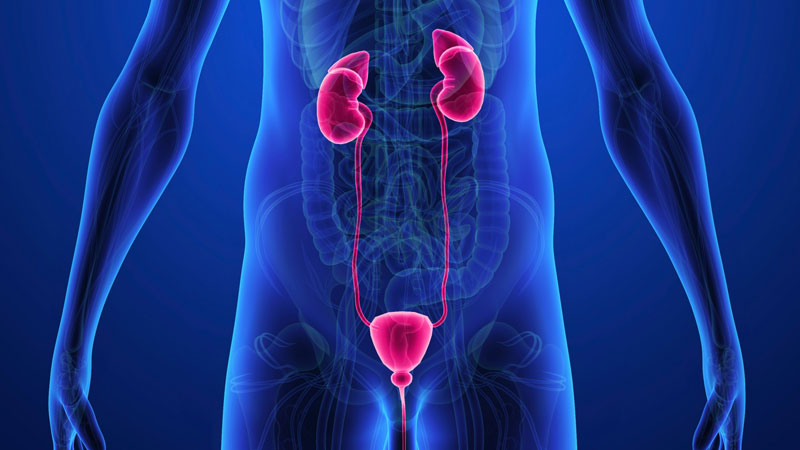 علایم انسداد پیشابراه علایم انسداد پیشابراه