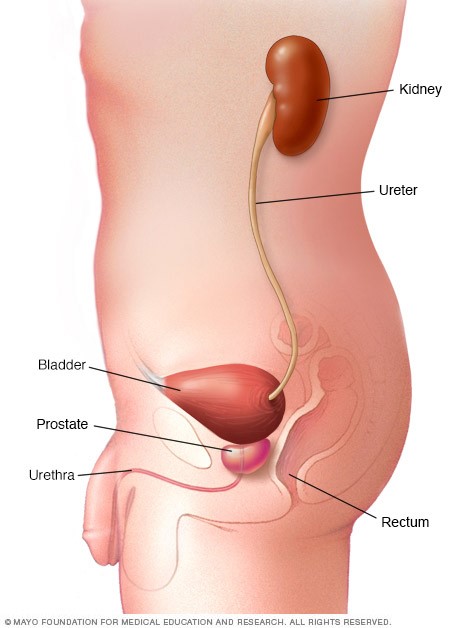 علایم انسداد پیشابراه علایم انسداد پیشابراه
